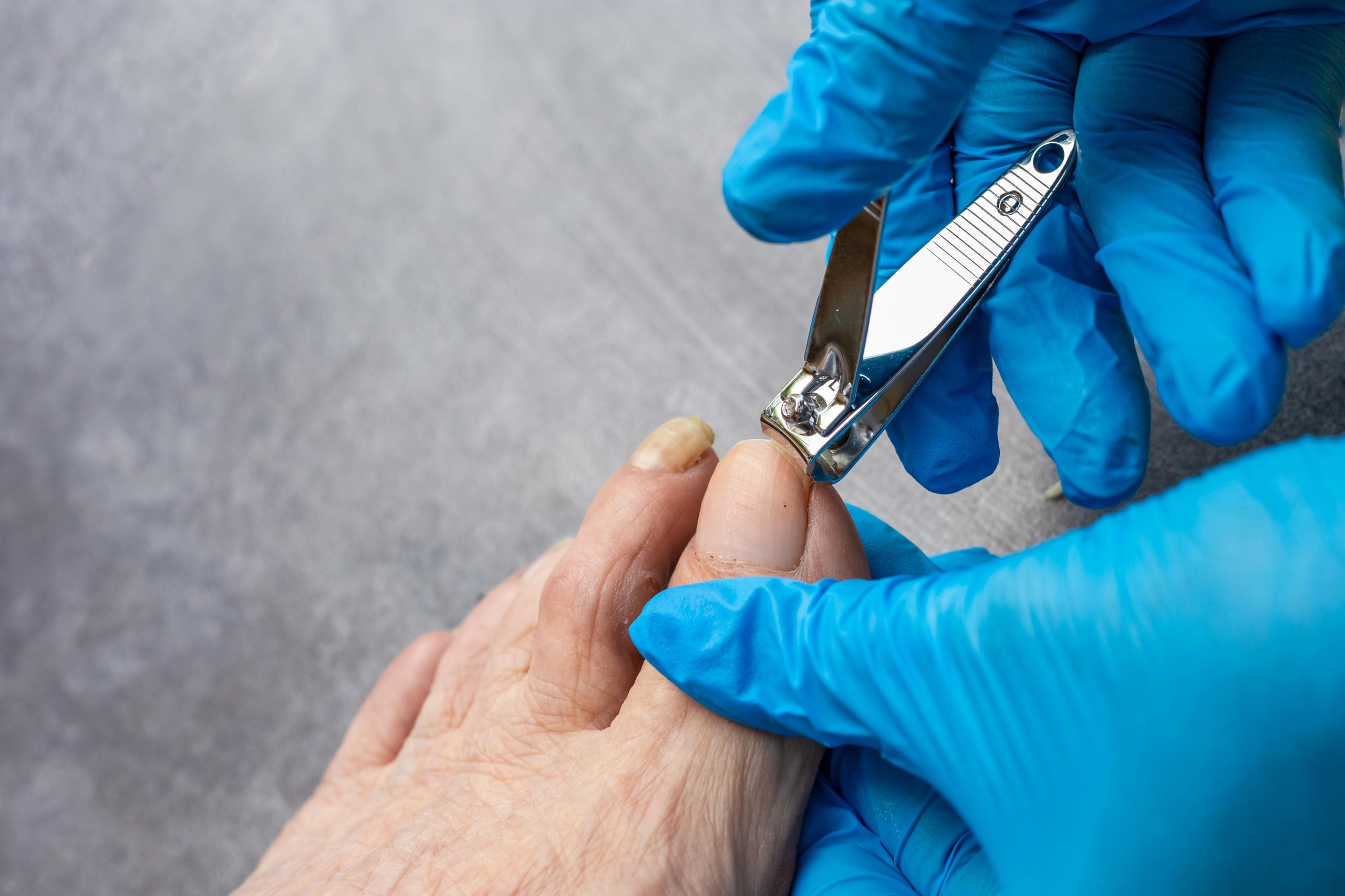 Foot Care